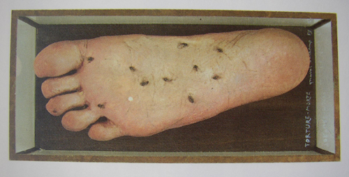 Les mouches comme points de contact.